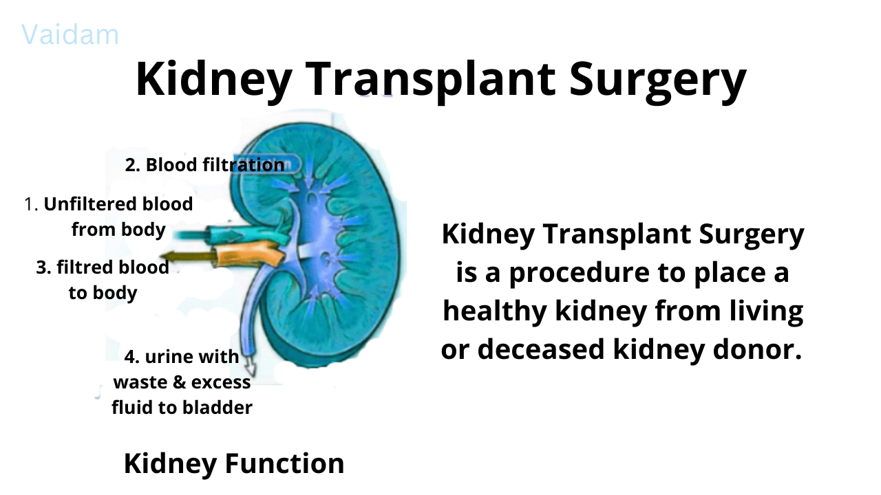 Kidney Transplant Surgery