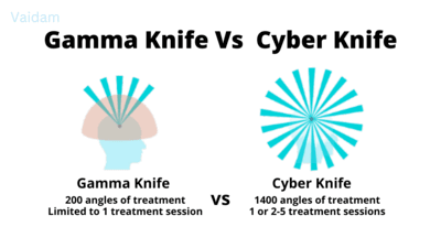 Gamma Knife vs Cyber knife treatment. 