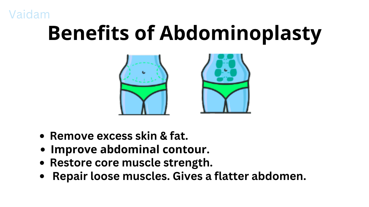 Benefits of Abdominoplasty.