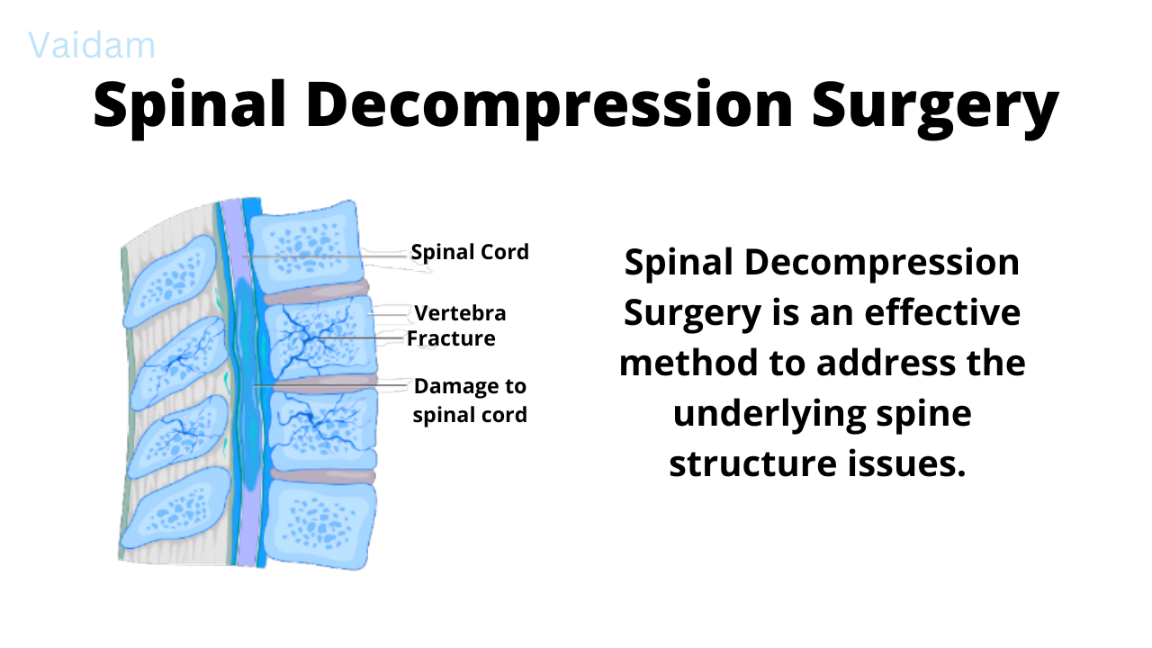 Spinal Decompression Surgery