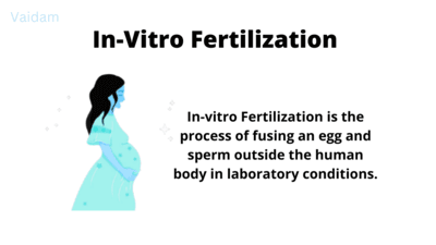 In-Vitro Fertilization
