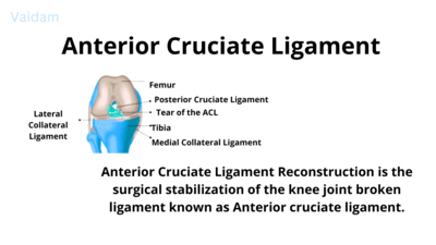 ACL - Anterior Cruciate Ligament 