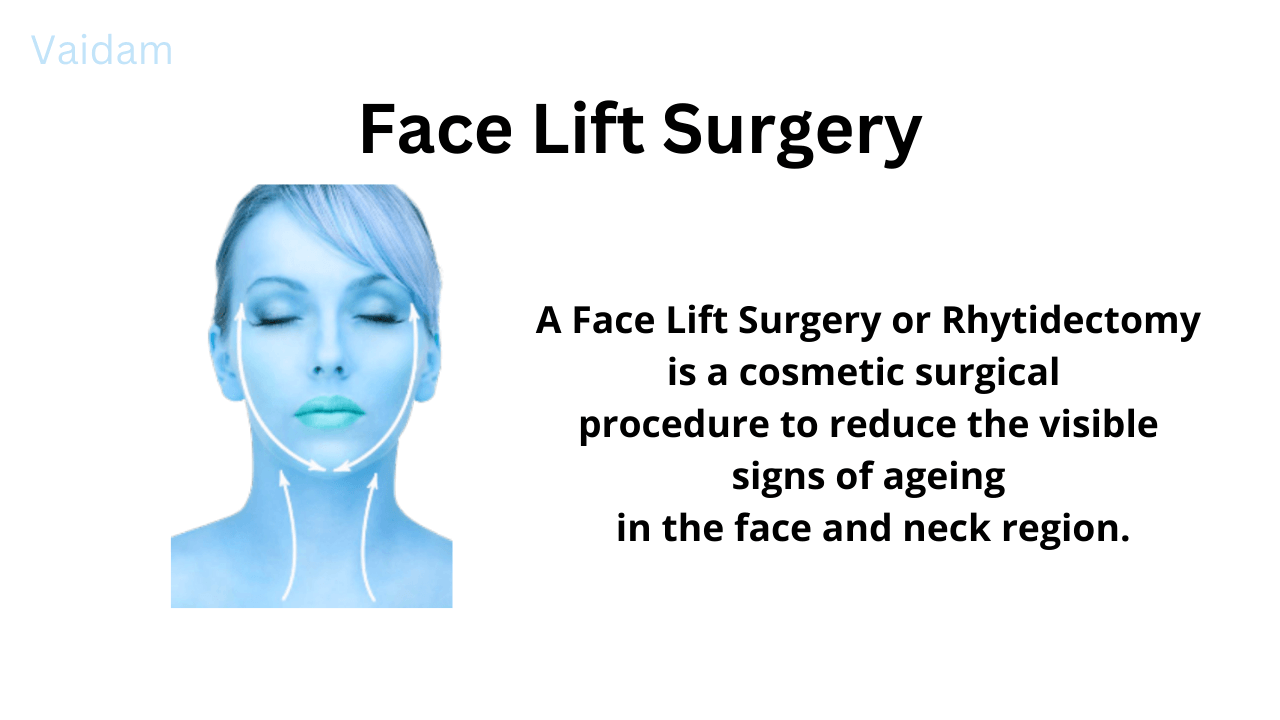  Face Lift Surgery