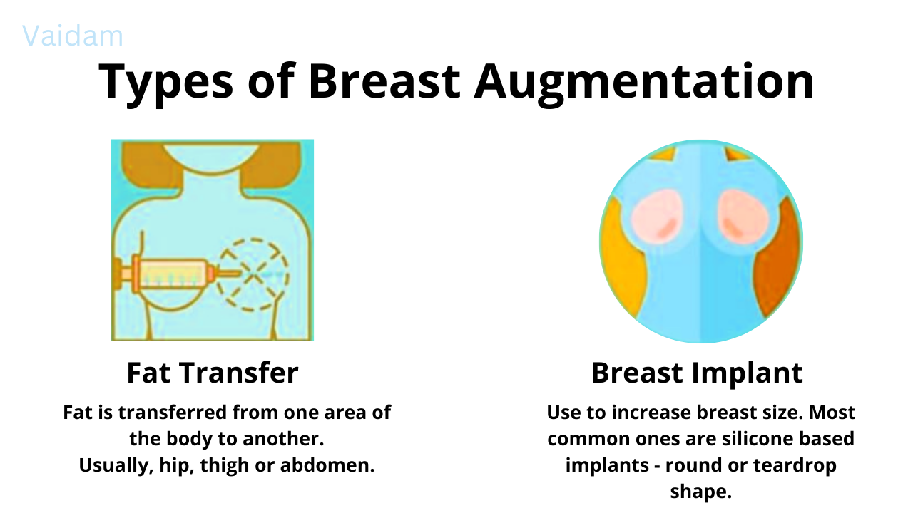 Types of Breast Augmentation.