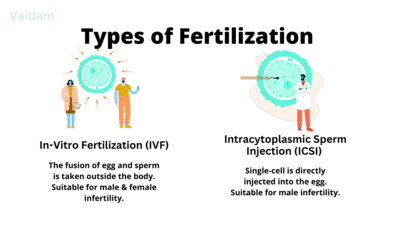 Types of Fertilization.