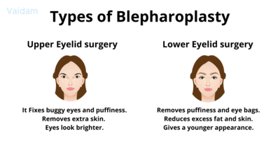 Types of Blepharoplasty surgery.