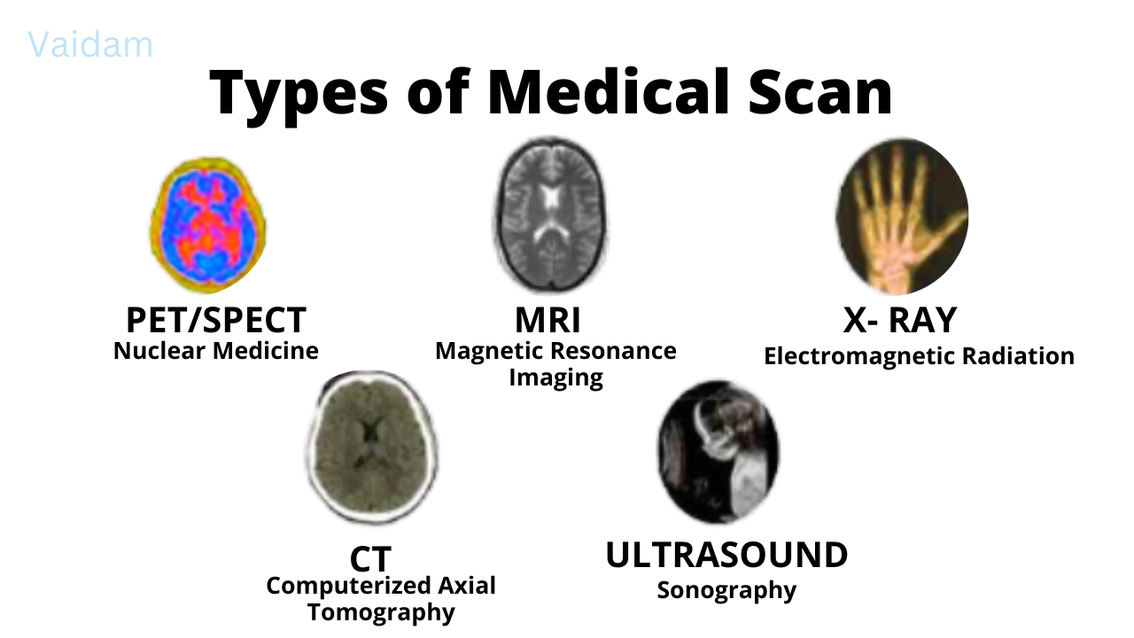 Type of Medical scans.