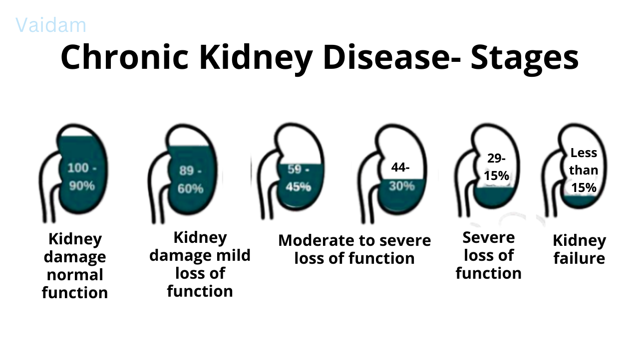 Stages of Chronic Kidney disease.