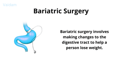 What is Bariatric surgery?