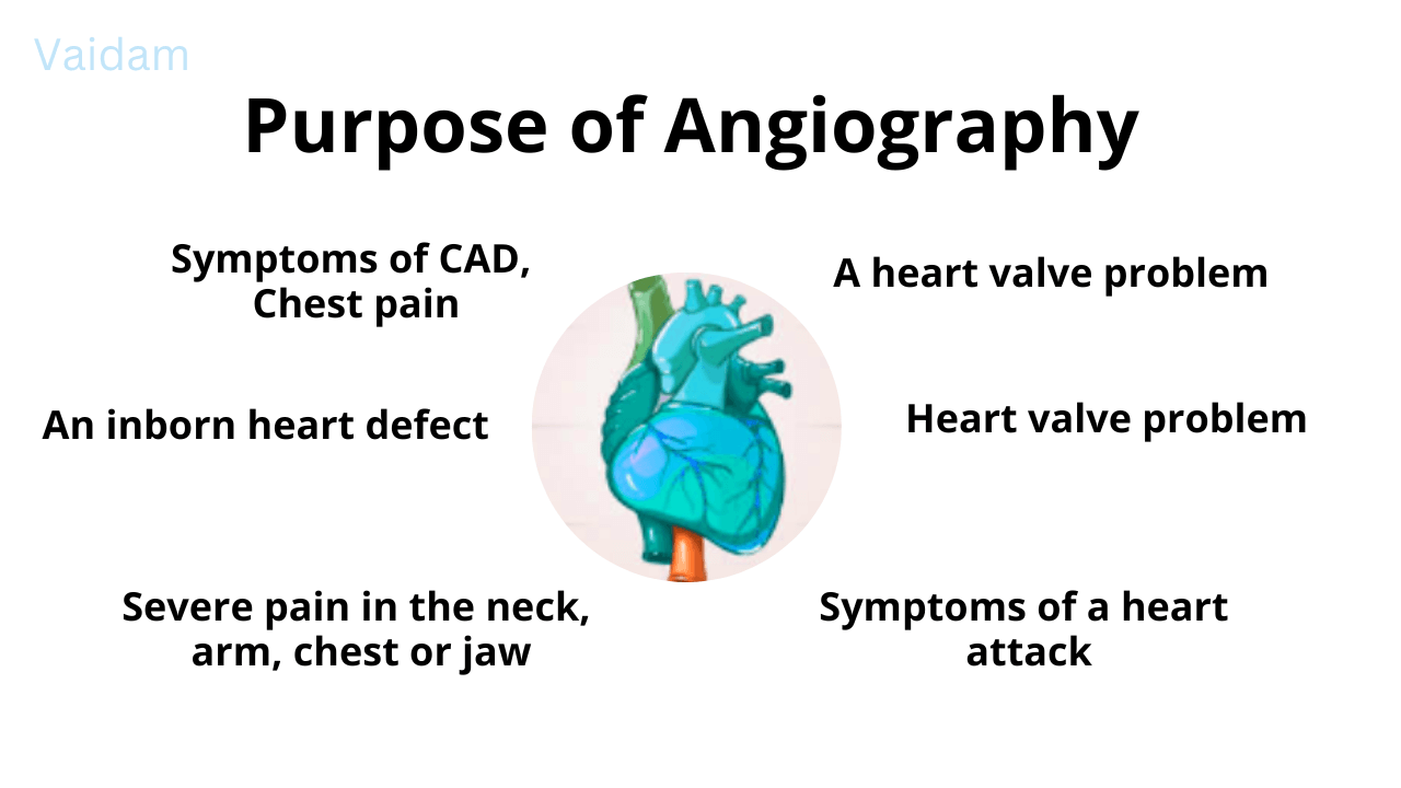 Purpose of Angiography.