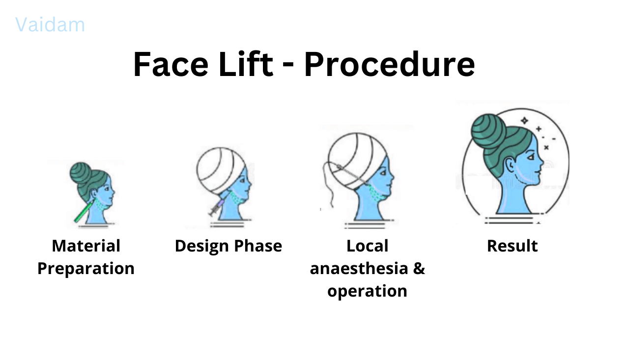  Procedure in Face Lift surgery.