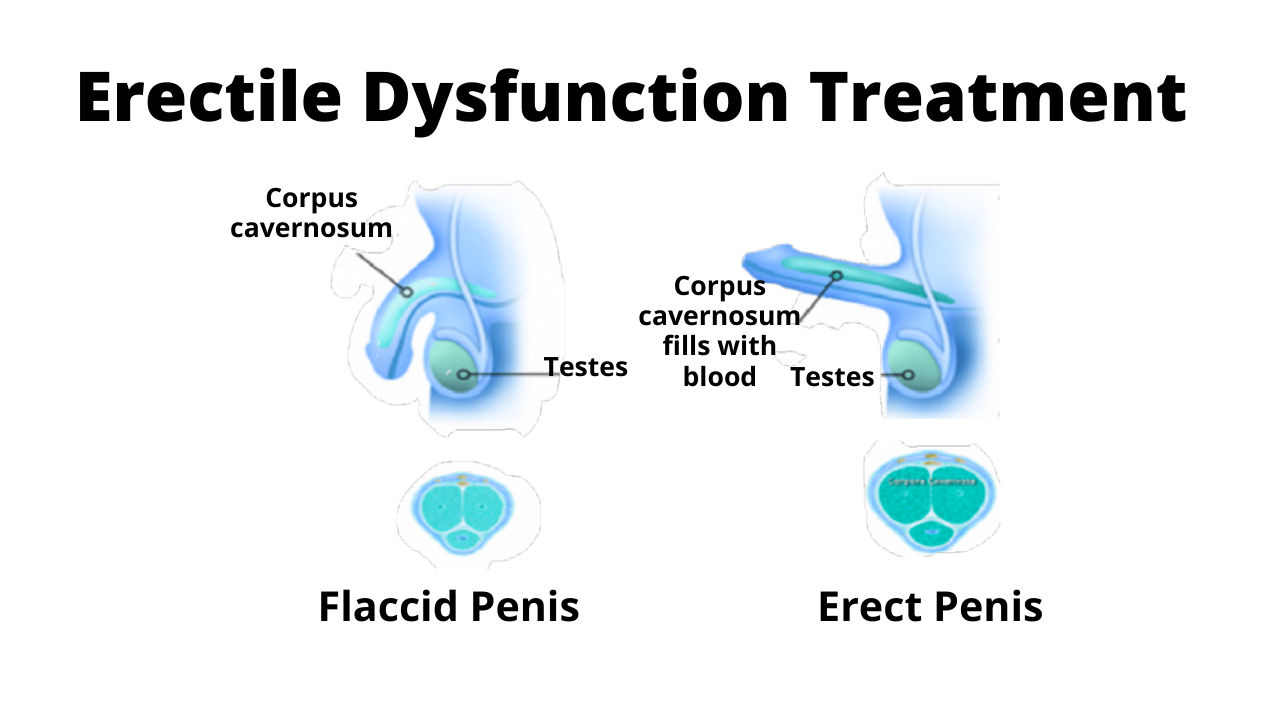  Treatment for Erectile Dysfunction.