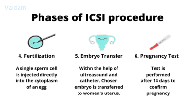 Fases da injeção intracitoplasmática de esperma.