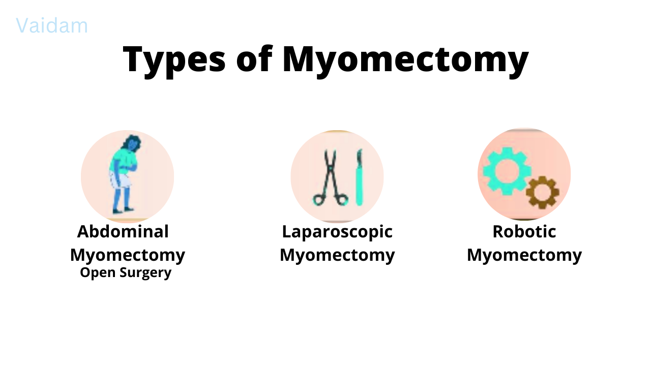 Types of Surgery.