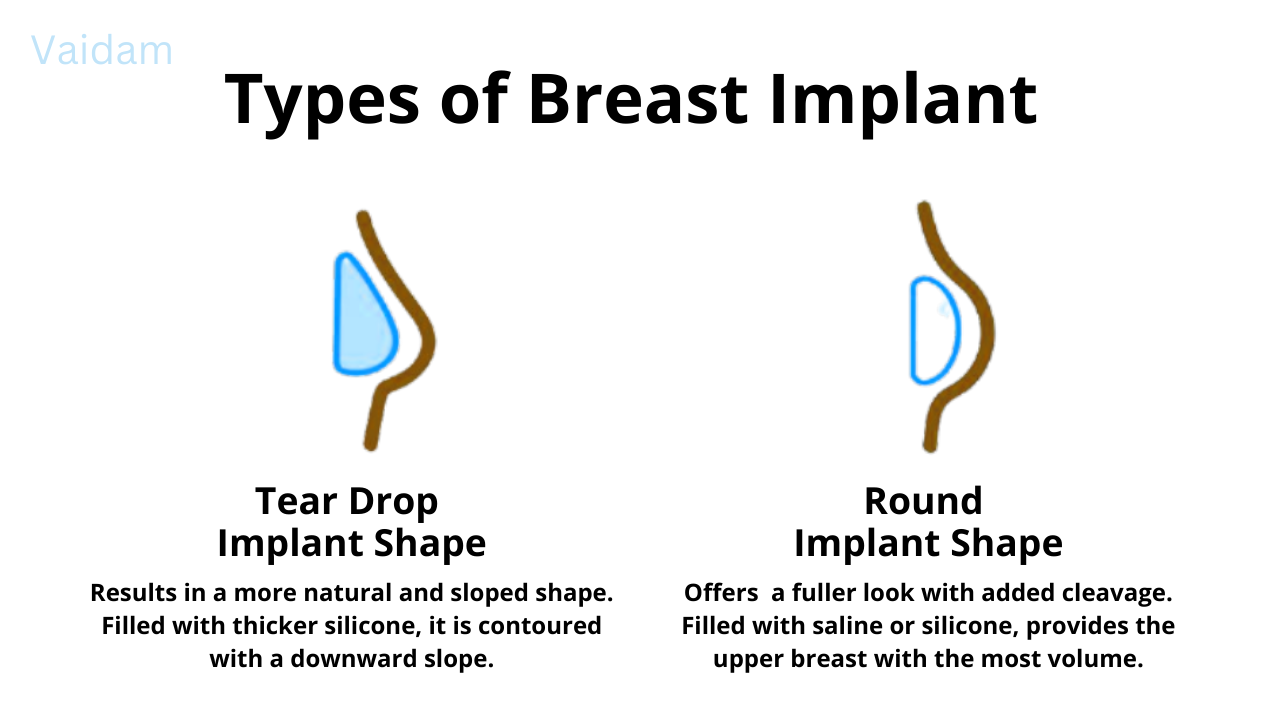 Types of breast implants.