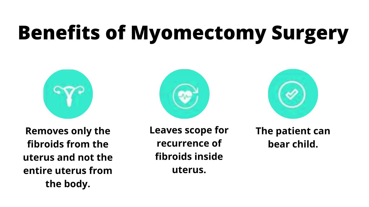  Benefits of Myomectomy Surgery.