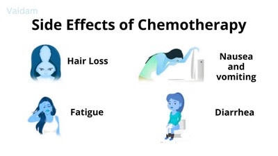 Side Effects of Chemotherapy.