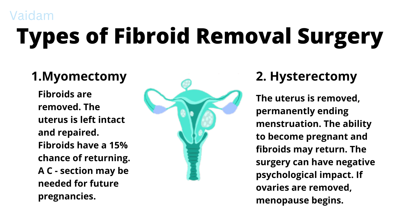 Types of Fibroid Removal Surgery.
