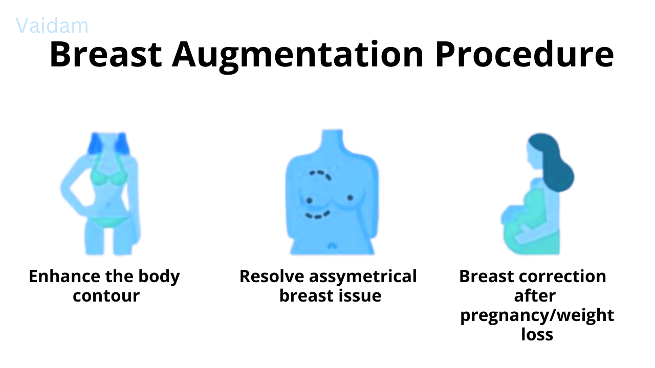 Procedure for Breast Augmentation.