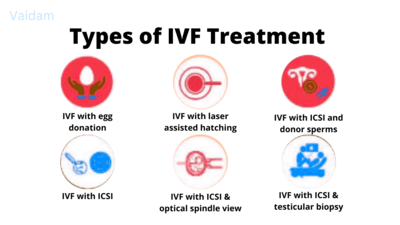 Types of IVF treatment.